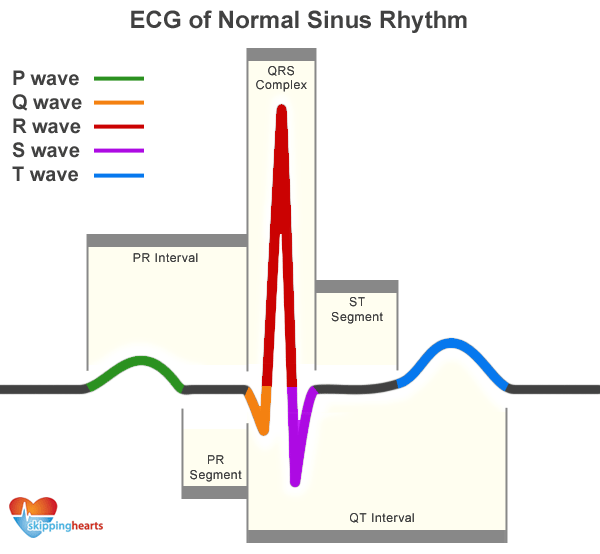 ecg_normal_sinus_rhythm1